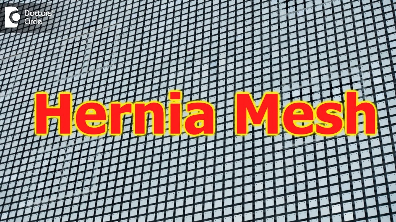 How long do hernia meshes last? More REF