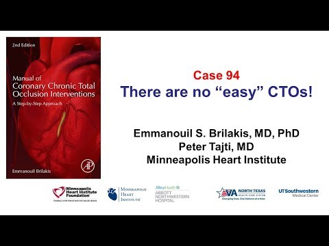 Case 94: Manual of CTO Interventions: There are no "simple" CTOs