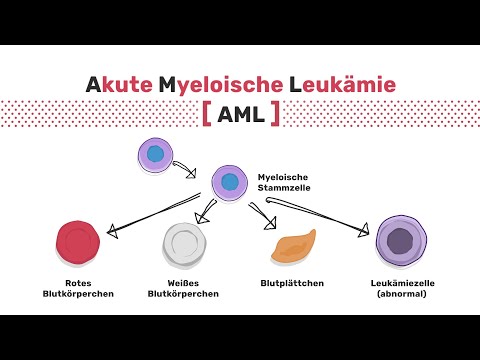 Akute myeloische Leukämie – Arten