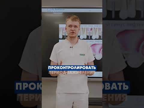 Всё, что нужно знать про All-on-6