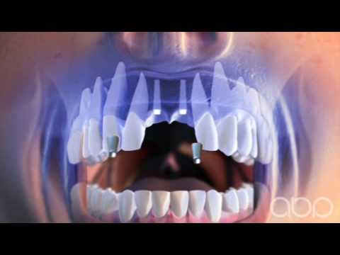 Dental Plaza