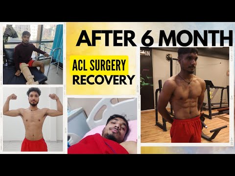 Acl Surgery | 6 month Recovery journey | Ayushman badoniya