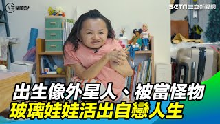 像外星人、被當怪物　玻璃娃娃活出自戀人生