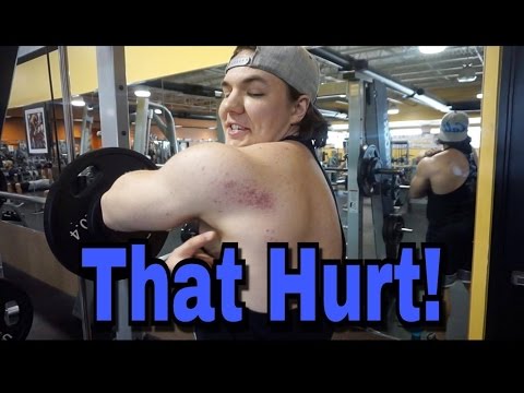 One of My Most Painful Experiences...