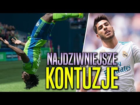 Zwiększenie kość kciuka Jak leczyć koślawego