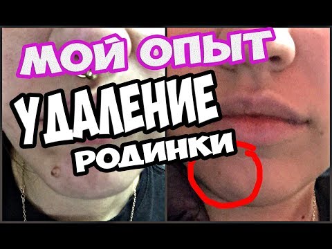 Хороший крем с отбеливающим эффектом Веснушки после пилинга