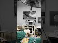 Laparoscopic Cholecystectomy | Gallbladder Removal Surgery