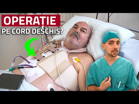 Cum scapi de durerea de inimă? - Dr. Paul Oargă