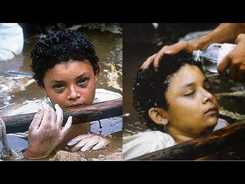 They Couldn't Save Her | Omayra Sanchez