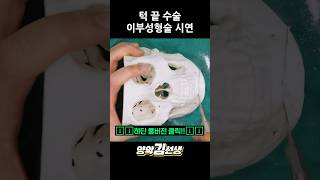 이부성형술 성형 시술