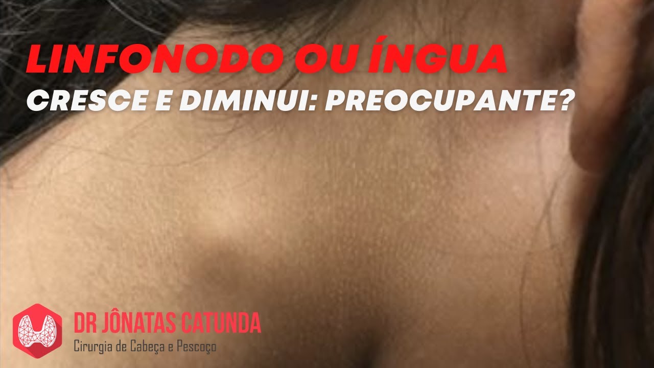 Linfonodo ou íngua no pescoço que cresce e diminui - É grave?