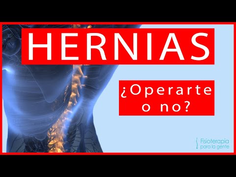 HERNIA ¿Cirugía o no? 🤷♂️