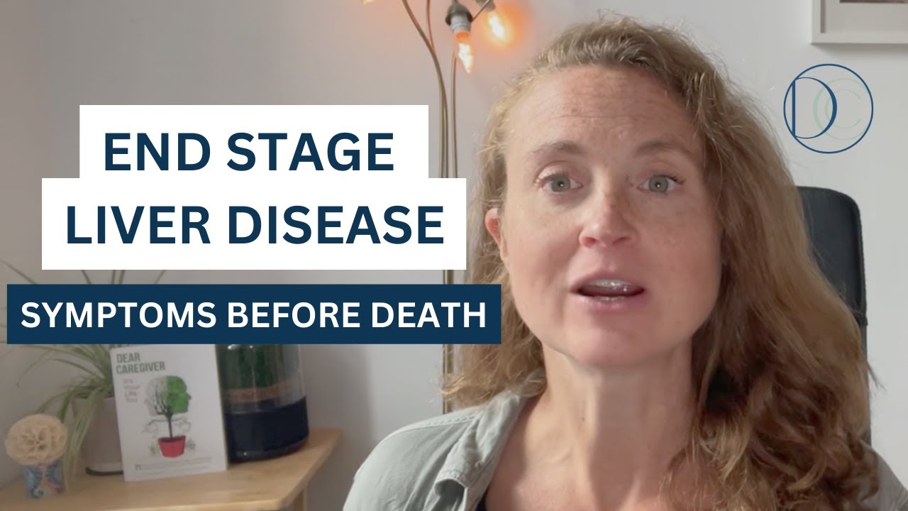 End Stage Liver Disease Symptoms Before Death #liverdisease