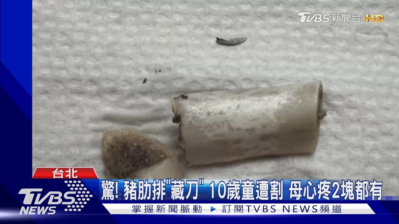 驚!豬肋排「藏刀」10歲童遭割 母心疼2塊都有