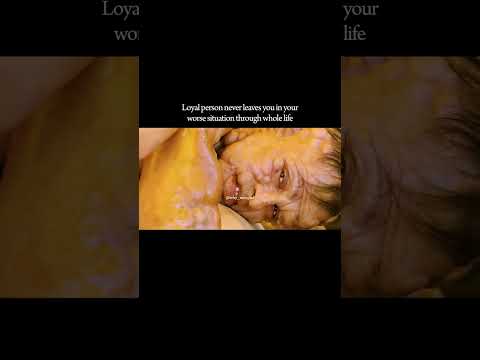 Loyal person never leaves you in your worse situation through whole life #truelove #imoveis