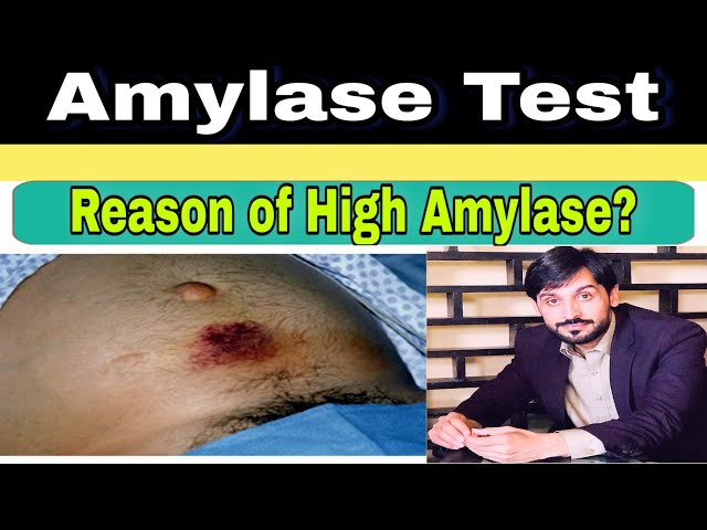 Video Pronunciation of Amylase in English