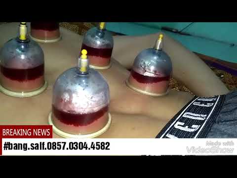 Jelly dan potensi Ulasan tinjauan Silver Fox Perempuan patogen