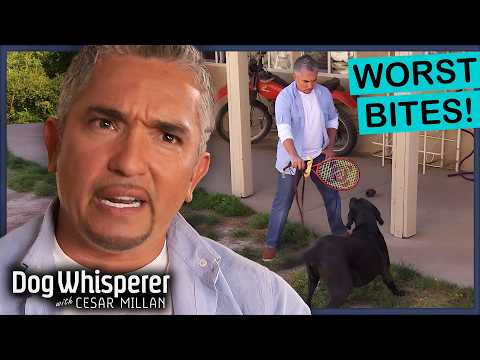 Cesar Millan’s Top 5 Worst Bites | Dog Whisperer Compilation
