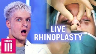 Would You Have A Nose Job After Watching This? | Plastic Surgery Undressed