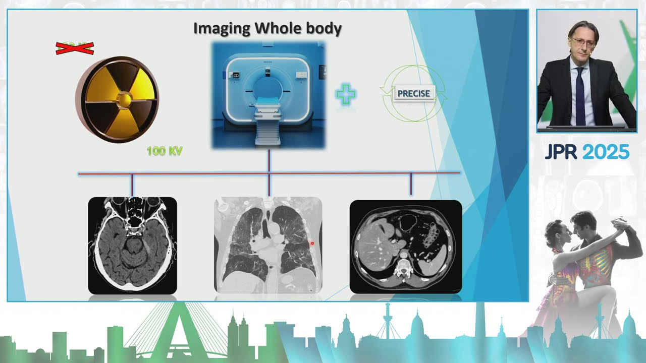 Explorando a Era da Inteligência Artificial da Tomografia Computadorizada