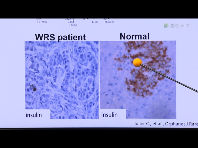 image-小胞体ストレス