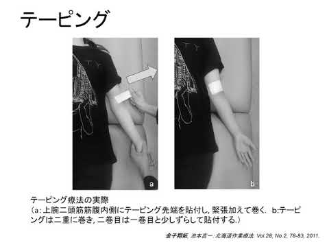 テニス肘に関する作業療法研究（0621オープンキャンパス模擬講義）　　北海道文教大学　作業療法学科