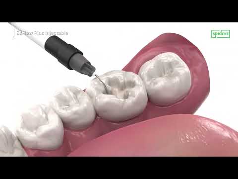 EsFlow PLUS Injectable 3D Simulation
