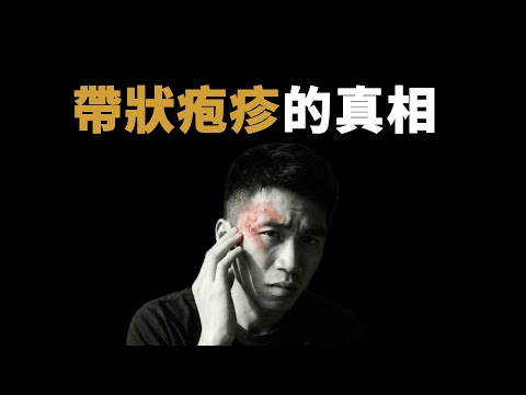 藏在90%的人體內的病毒，為什麼它沒有像天花一樣滅絕，為什麼會讓人這麼疼｜鹿哥Gustav
