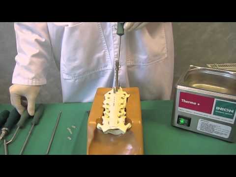 Inion S-1™ Spinal Graft Containment System