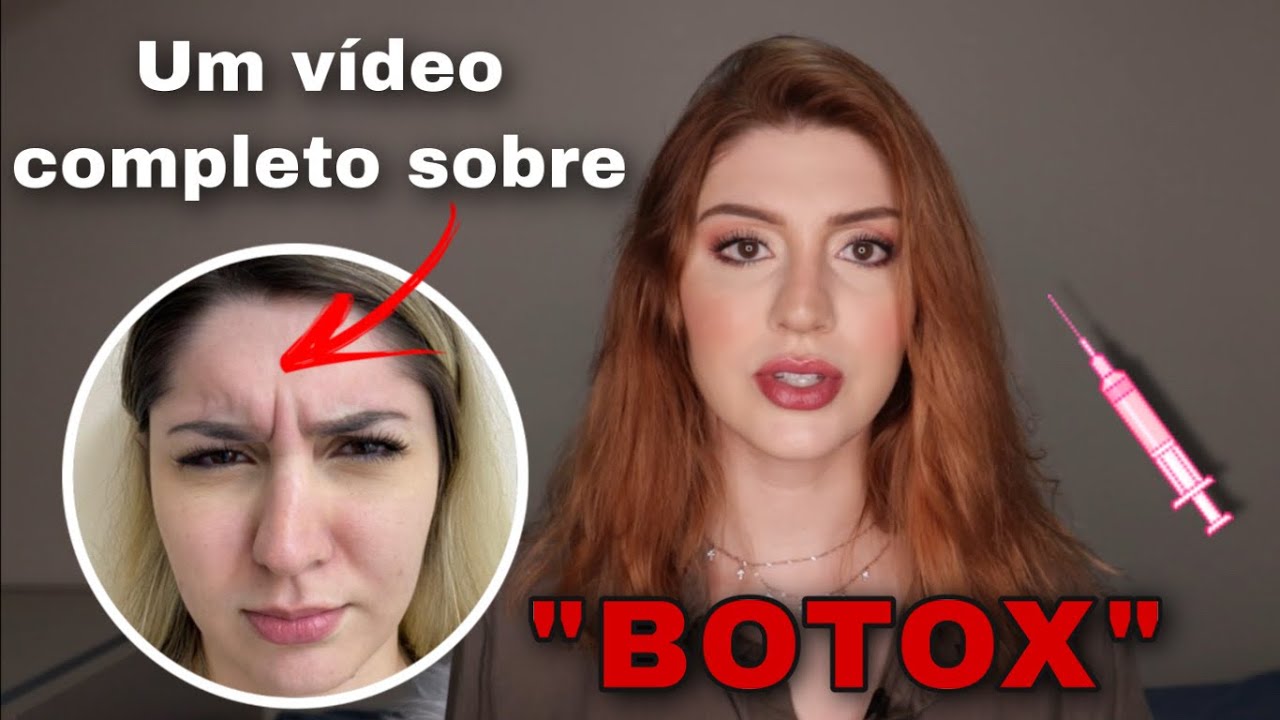 💉 BOTOX (toxina botulínica): diário do resultado, preço, riscos () e outras DÚVIDAS
