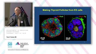 Pregnancy and Autoimmune Thyroid Disease