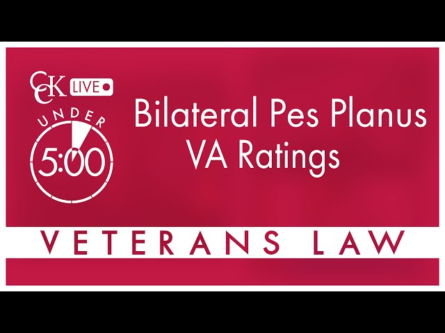 Bilateral Pes Planus (Flat Feet) VA Ratings