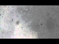 E Coli Video