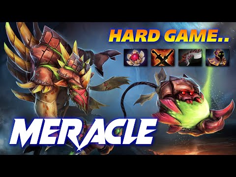 Meracle Bristleback - HARD GAME - Dota 2 Pro Gameplay [Watch & Learn]