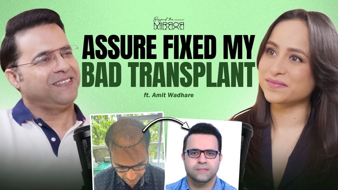 Amit Wadhare on having a failed hair transplant corrected at Assure Clinic, full interview