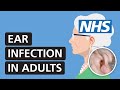 Ear infection in adults: Symptoms and how to relieve pain | NHS