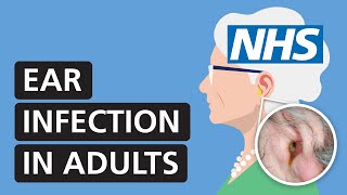 Ear infection in adults: symptoms, treatment and pain relief | NHS
