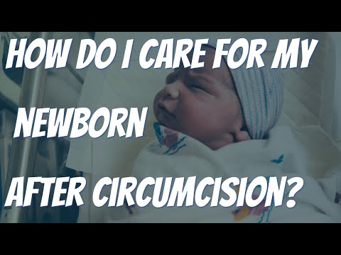 HOW DO I CARE FOR MY SON AFTER A NEWBORN CIRCUMCISION?