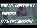 HOW DO I CARE FOR MY SON AFTER A NEWBORN CIRCUMCISION