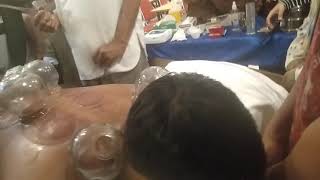 Download lagu Teknik Bekam Api Fire Cupping oleh shinshe dr. Ali Ridho belajar synergy medis timur & barat mp3 Download lagu Teknik Bekam Api Fire Cupping oleh shinshe dr. Ali Ridho belajar synergy medis timur & barat mp3