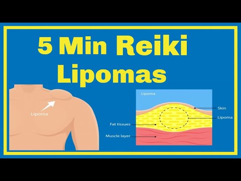 Reiki l Lipoma l  5 Minute Session l Healing Hands Series