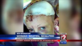 Sheriff: Woman beaten by ex, attacked by dog