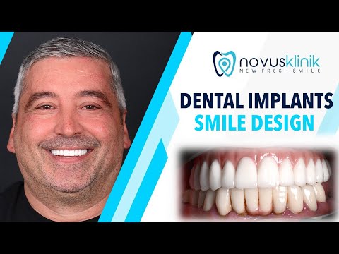 Achieve a Perfect Smile: Upper Jaw Implants & Zirconia Crowns in Turkey