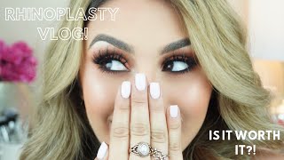 Rhinoplasty/Septoplasty VLOG! The FULL Experience