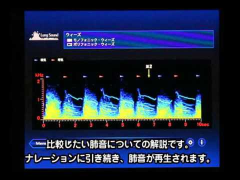 肺の聴診トレーニング－見える肺音 video