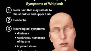 Whiplash Injury Animation - Everything You Need to Know  - Dr. Nabil Ebraheim, M.D.