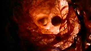 Michael Penn - Seen The Doctor HQ