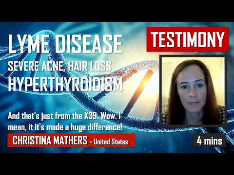 Testimonio X39 dolor de cuerpo