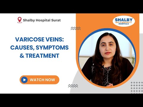 Varicose Veins: Causes, Symptoms & Treatment