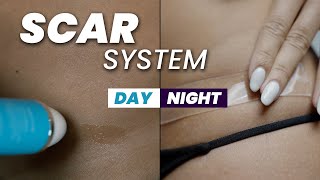 Scar Healing Secrets: Dr. William's Tips for a Flawless Recovery